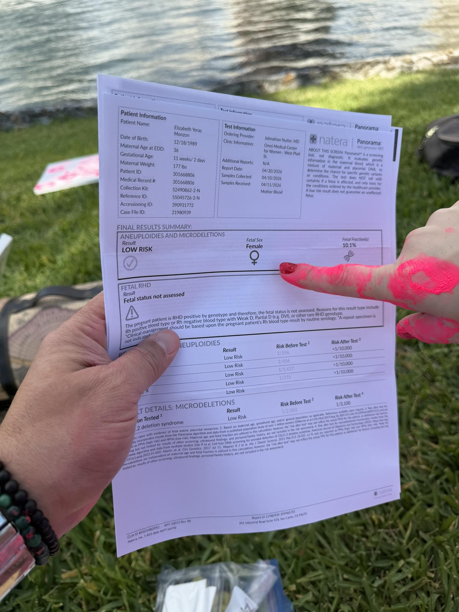 The prenatal test result revealing a baby girl